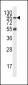 PI3KR5 Antibody (Center)